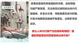 4.5 人體內(nèi)廢物的排出 課件 2024-2025學年人教版生物七年級下冊